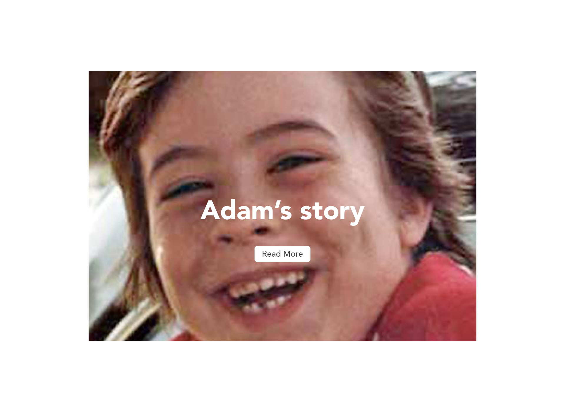 close up of adam's face, smiling, missing bottom tooth